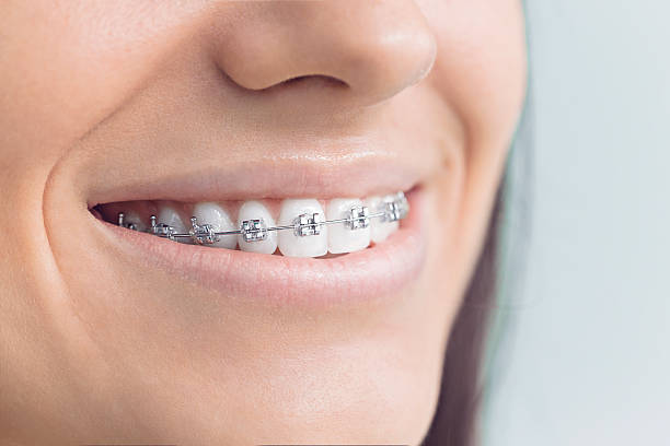 Best Dental Inlays and Onlays  in Fremont, NE